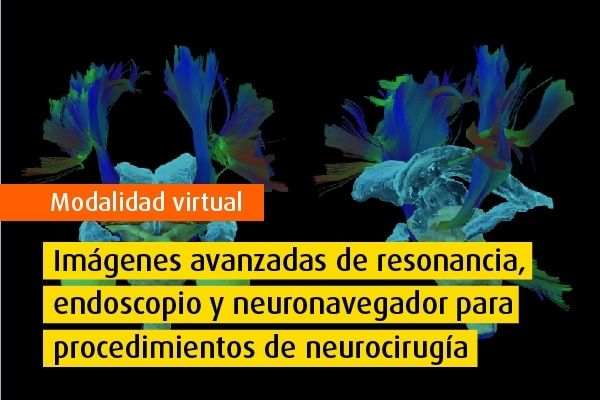 Curso virtual - Imágenes avanzadas de resonancia, endoscopio y neuronavegador para procedimientos de neurocirugía